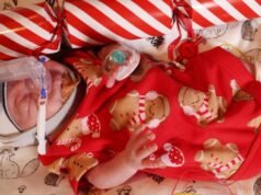 Novorodenec Charlie Jones sa považoval za najmenší v Queenslande s „pozoruhodnými“ 360 g